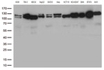 CTNND1 Antibody in Western Blot (WB)