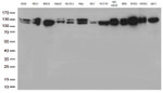 CTNND1 Antibody in Western Blot (WB)