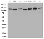 CTNND1 Antibody in Western Blot (WB)