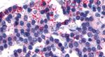 Calcitonin Receptor Antibody in Immunohistochemistry (Paraffin) (IHC (P))