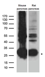 CTRL Antibody in Western Blot (WB)