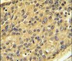 Cathepsin H Antibody in Immunohistochemistry (IHC)