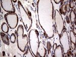 CTSL1 Antibody in Immunohistochemistry (Paraffin) (IHC (P))