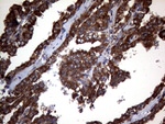 CTSL1 Antibody in Immunohistochemistry (Paraffin) (IHC (P))
