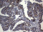 CTSL1 Antibody in Immunohistochemistry (Paraffin) (IHC (P))