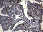 CTSL1 Antibody in Immunohistochemistry (Paraffin) (IHC (P))