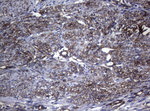 CTSL1 Antibody in Immunohistochemistry (Paraffin) (IHC (P))