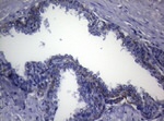CTSL1 Antibody in Immunohistochemistry (Paraffin) (IHC (P))