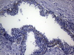 CTSL1 Antibody in Immunohistochemistry (Paraffin) (IHC (P))
