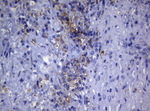 CTSL1 Antibody in Immunohistochemistry (Paraffin) (IHC (P))