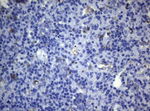 CTSL1 Antibody in Immunohistochemistry (Paraffin) (IHC (P))