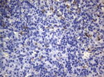 CTSL1 Antibody in Immunohistochemistry (Paraffin) (IHC (P))