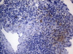 CTSL1 Antibody in Immunohistochemistry (Paraffin) (IHC (P))