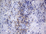 CTSL1 Antibody in Immunohistochemistry (Paraffin) (IHC (P))