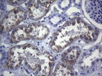 CTSL1 Antibody in Immunohistochemistry (Paraffin) (IHC (P))