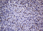 CTSL1 Antibody in Immunohistochemistry (Paraffin) (IHC (P))