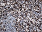 CTSL1 Antibody in Immunohistochemistry (Paraffin) (IHC (P))