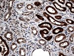 CTSL1 Antibody in Immunohistochemistry (Paraffin) (IHC (P))