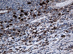 CTSL1 Antibody in Immunohistochemistry (Paraffin) (IHC (P))