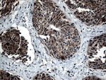 CTSL1 Antibody in Immunohistochemistry (Paraffin) (IHC (P))