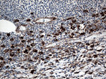 CTSL1 Antibody in Immunohistochemistry (Paraffin) (IHC (P))