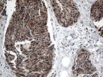 CTSL1 Antibody in Immunohistochemistry (Paraffin) (IHC (P))
