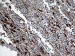 CTSL1 Antibody in Immunohistochemistry (Paraffin) (IHC (P))