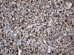 CTSL1 Antibody in Immunohistochemistry (Paraffin) (IHC (P))