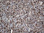 CTSL1 Antibody in Immunohistochemistry (Paraffin) (IHC (P))