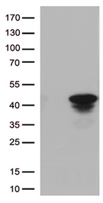 CTSL1 Antibody in Western Blot (WB)