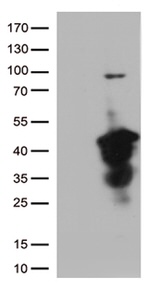 CTSL1 Antibody in Western Blot (WB)