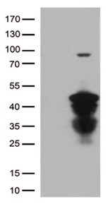 CTSL1 Antibody in Western Blot (WB)
