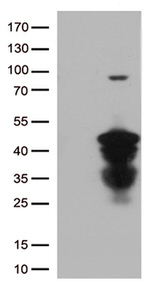 CTSL1 Antibody in Western Blot (WB)