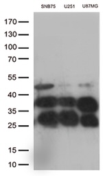 CTSL1 Antibody in Western Blot (WB)