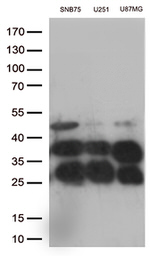 CTSL1 Antibody in Western Blot (WB)