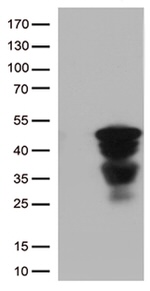 CTSL1 Antibody in Western Blot (WB)