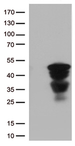 CTSL1 Antibody in Western Blot (WB)
