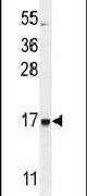 C21orf2 Antibody in Western Blot (WB)