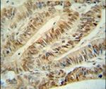 Cullin 5 Antibody in Immunohistochemistry (IHC)