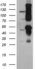 CUX1/Protein CASP Antibody in Western Blot (WB)