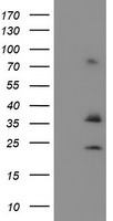 CYB5R1 Antibody in Western Blot (WB)