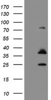 CYB5R1 Antibody in Western Blot (WB)