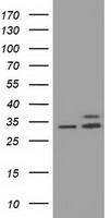 CYB5R3 Antibody in Western Blot (WB)