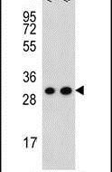 Cytochrome C1 Antibody in Western Blot (WB)