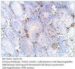 Cyclin D1 Antibody in Immunohistochemistry (IHC)