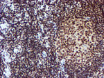 CYP17A1 Antibody in Immunohistochemistry (Paraffin) (IHC (P))