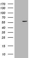 CYP17A1 Antibody in Western Blot (WB)
