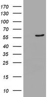 CYP2A6 Antibody in Western Blot (WB)