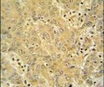 CYP2A7 Antibody in Immunohistochemistry (IHC)