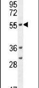 CYP2A7 Antibody in Western Blot (WB)